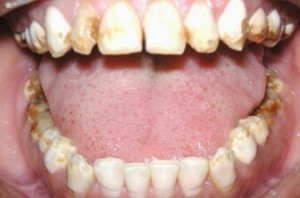 gigi-keropos_resized_1